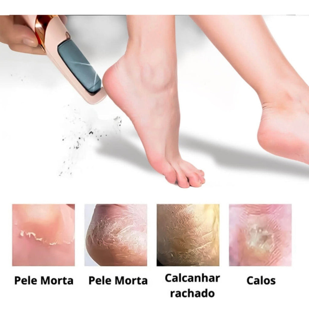 Lima Exfoliador Remueve Callos Pies Recargable