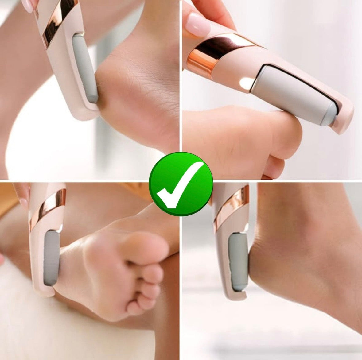 Lima Exfoliador Remueve Callos Pies Recargable